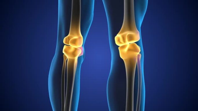 膝关节疼痛的医学概念