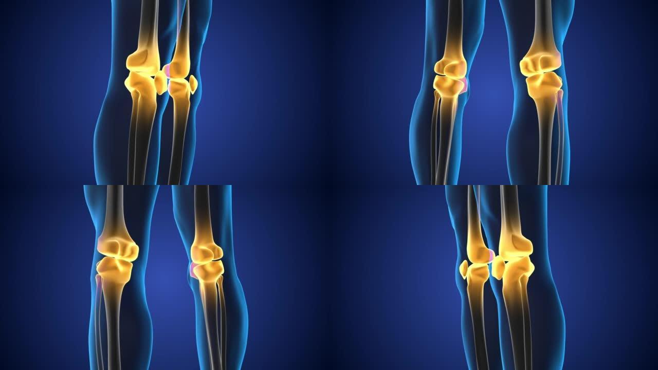 膝关节疼痛的医学概念