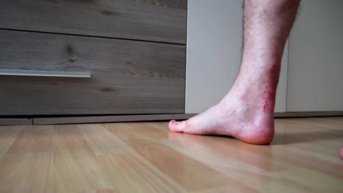 跟腱断裂手术后的欧洲男子通过康复物理治疗师的指导，通过痛苦的锻炼训练他的跟腱愈合，以恢复脚跟和脚踝的