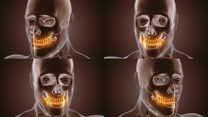 牙齿疼痛的医学动画