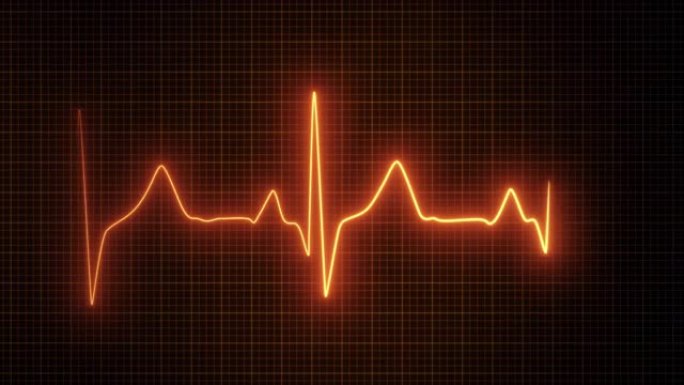 动态心率或心跳线。心电图信号。红色。病人的生命体征。脉冲测量。