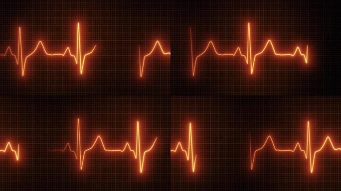 动态心率或心跳线。心电图信号。红色。病人的生命体征。脉冲测量。