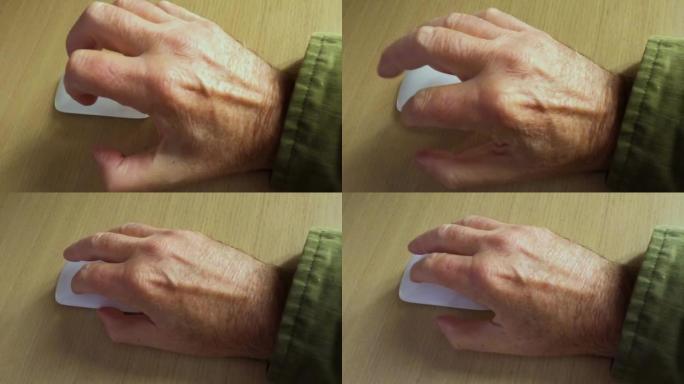 一只成熟的手在使用鼠标时伸出来。重复应变或关节刚度概念。