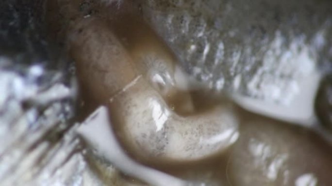 眼底造口菌的研究。在实验室显微镜下观察。
