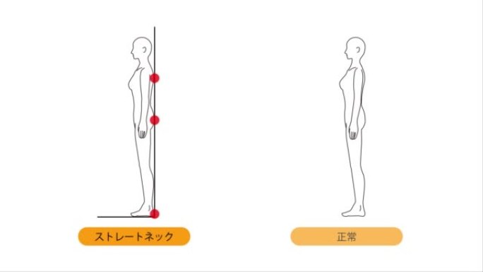 这是一个动画视频，说明了如何自我检查直颈。