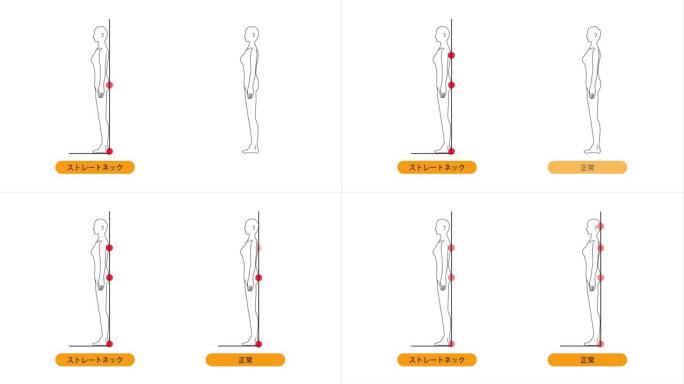 这是一个动画视频，说明了如何自我检查直颈。