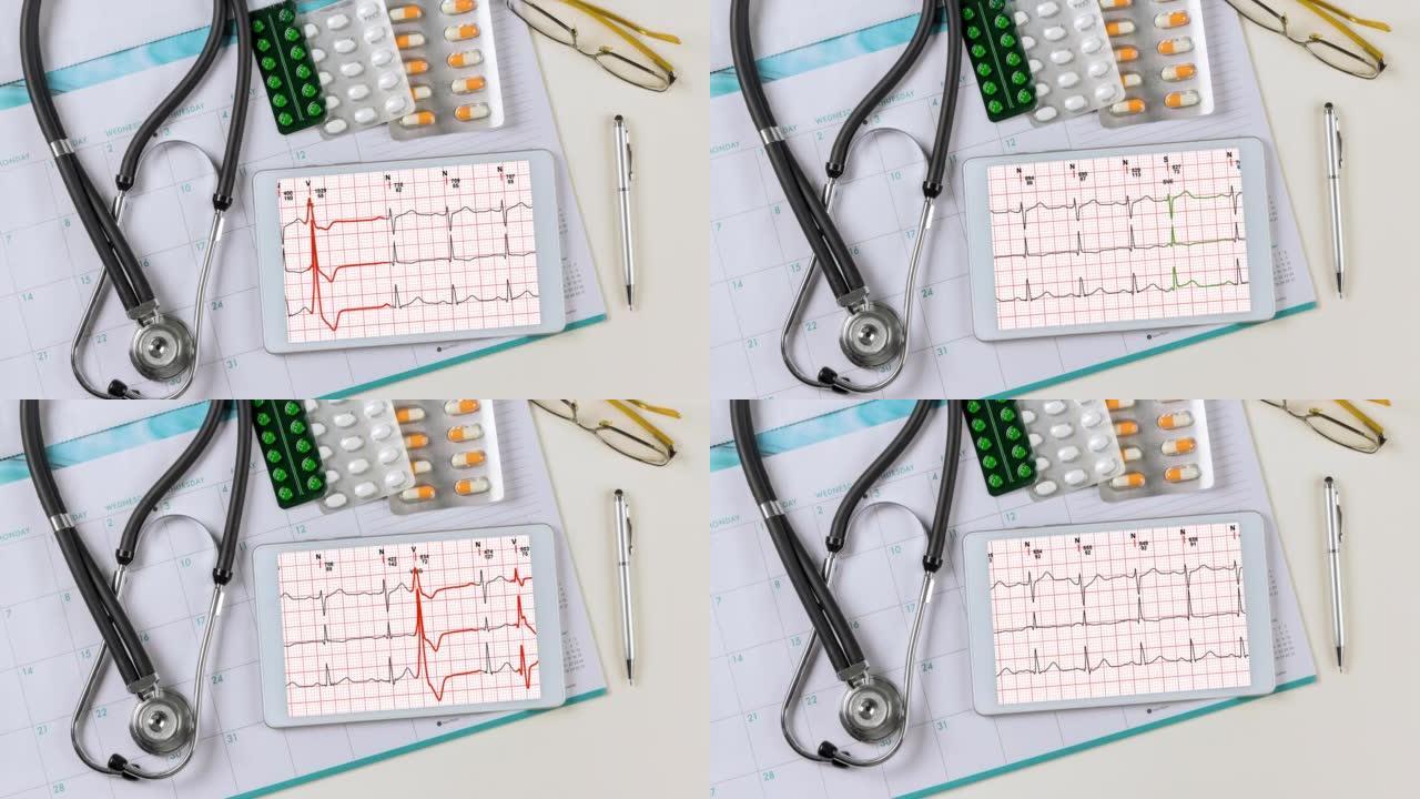 医用工作台工作台以心电心电图、心电图、心电图报告分析病人在数码平板上