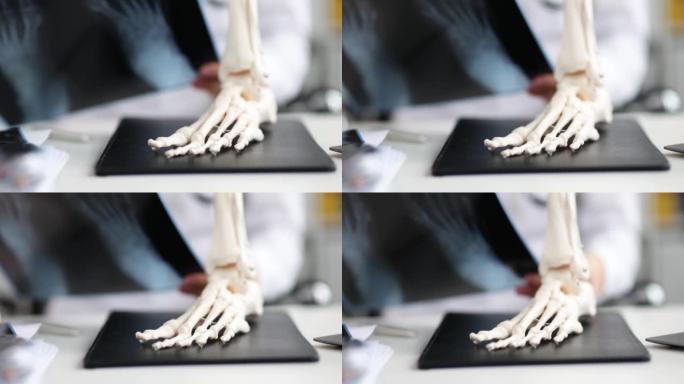 患者足部骨骼的x射线图像和模型