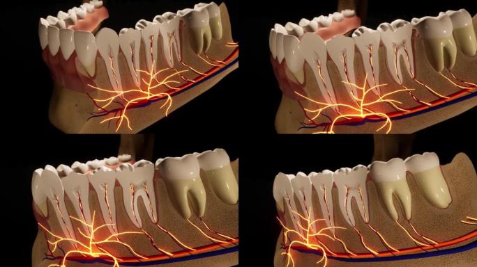 龋齿损坏的臼齿。医学上精确的牙齿3D动画