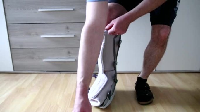 男子拆包和拆箱脚跟腱断裂手术后的第一步，用月靴显示缝线和手术横切行走赤脚，疼痛和部分负重PWB