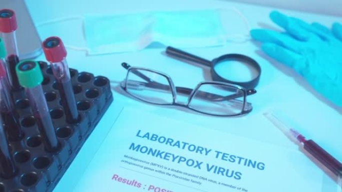 注射器和采血管以及实验室中猴痘测试结果的数据表。