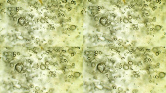 苹果在显微镜下漂浮着细菌、微生物和细菌。被咬苹果表面的感染视图。水果的微观视图。在一个范围内的苹果里