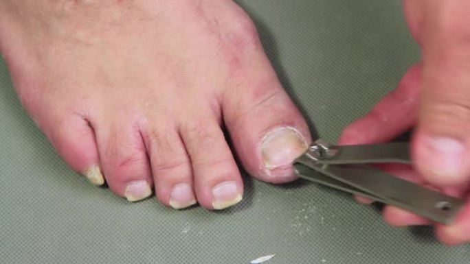 一只手在用剪刀剪一名男子的脚趾甲。