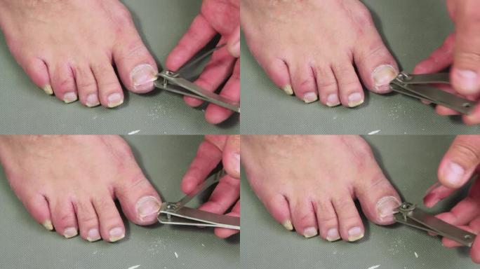 一只手在用剪刀剪一名男子的脚趾甲。
