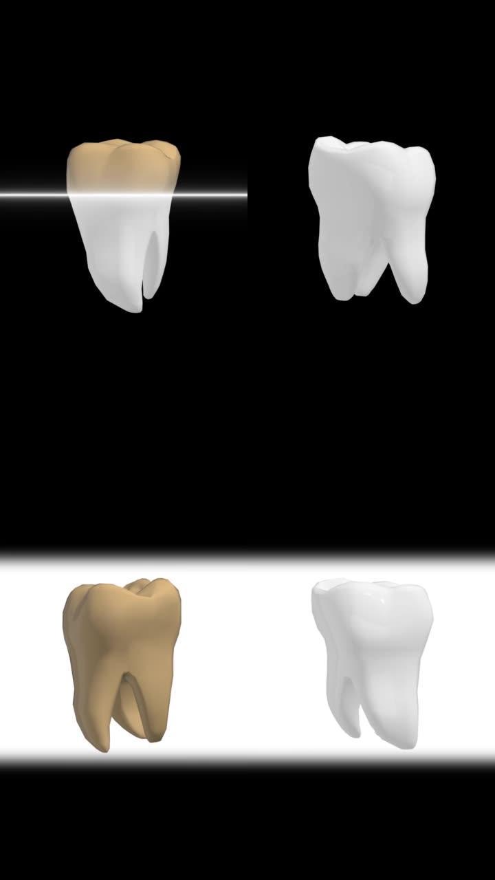 旋转3D牙齿的美白治疗。垂直4k。