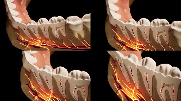 牙痛。牙齿的解剖详细部分。神经发炎。3D动画