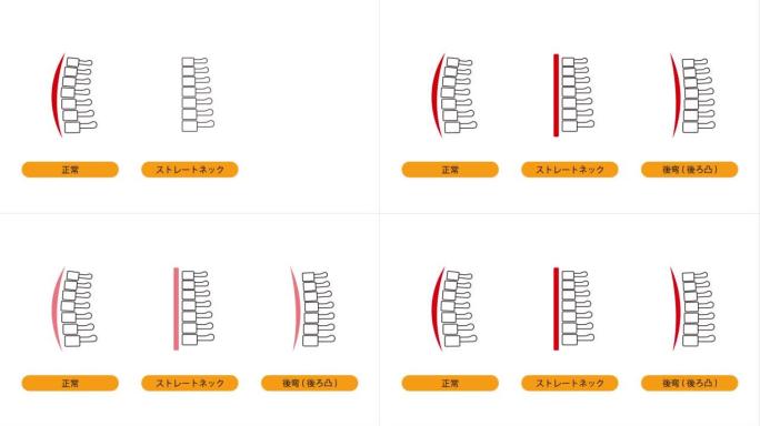 这是一个动画视频，显示了直颈，颈椎后凸和正常颈骨的图像。