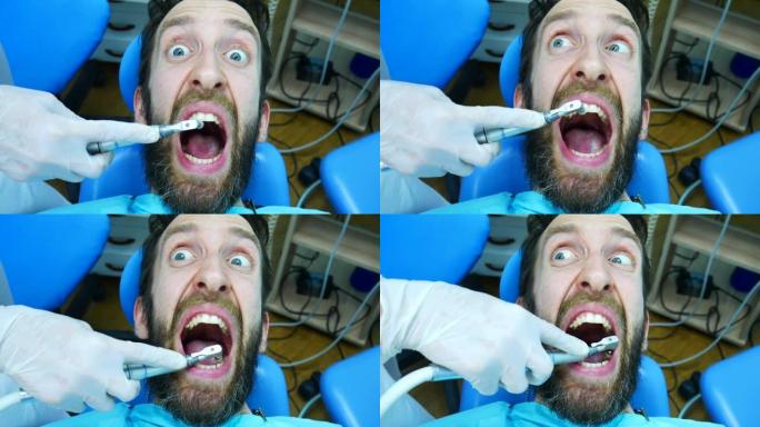 一个年轻的大胡子男人害怕专业人士刷牙，坐在牙医的椅子上惊恐地尖叫
