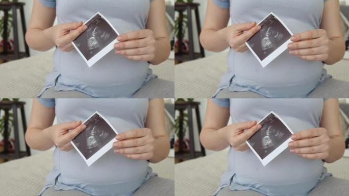 监测怀孕的现代技术。通过超声波确定孩子的性别。未出生婴儿的第一张胎儿照片