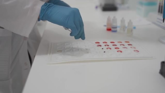 红细胞相容性表。捐赠。捐赠者和接受者。实验室技术人员进行血液测试以确定血型，Rh因子和相容性。不同类