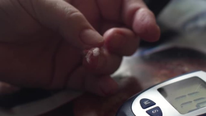 血糖仪筛查血糖值高及血糖试验后用棉絮对女性手指1型糖尿病患者的健康监测选择性聚焦