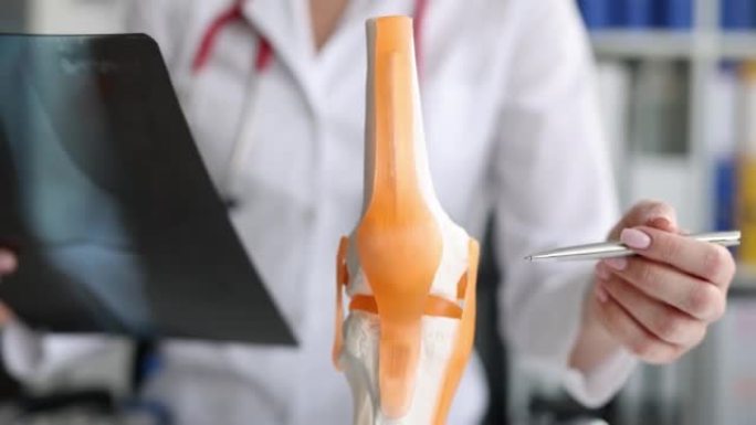 医生对患有骨关节炎或模拟腿关节病的腿进行x射线检查