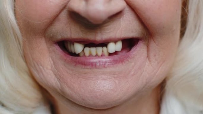 女老年女性无牙微笑嘴的特写宏牙齿问题，牙齿脱落不良