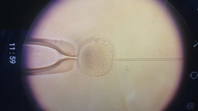 emale卵子在强大的显微镜下被精子细胞受精。