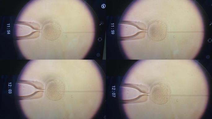 emale卵子在强大的显微镜下被精子细胞受精。