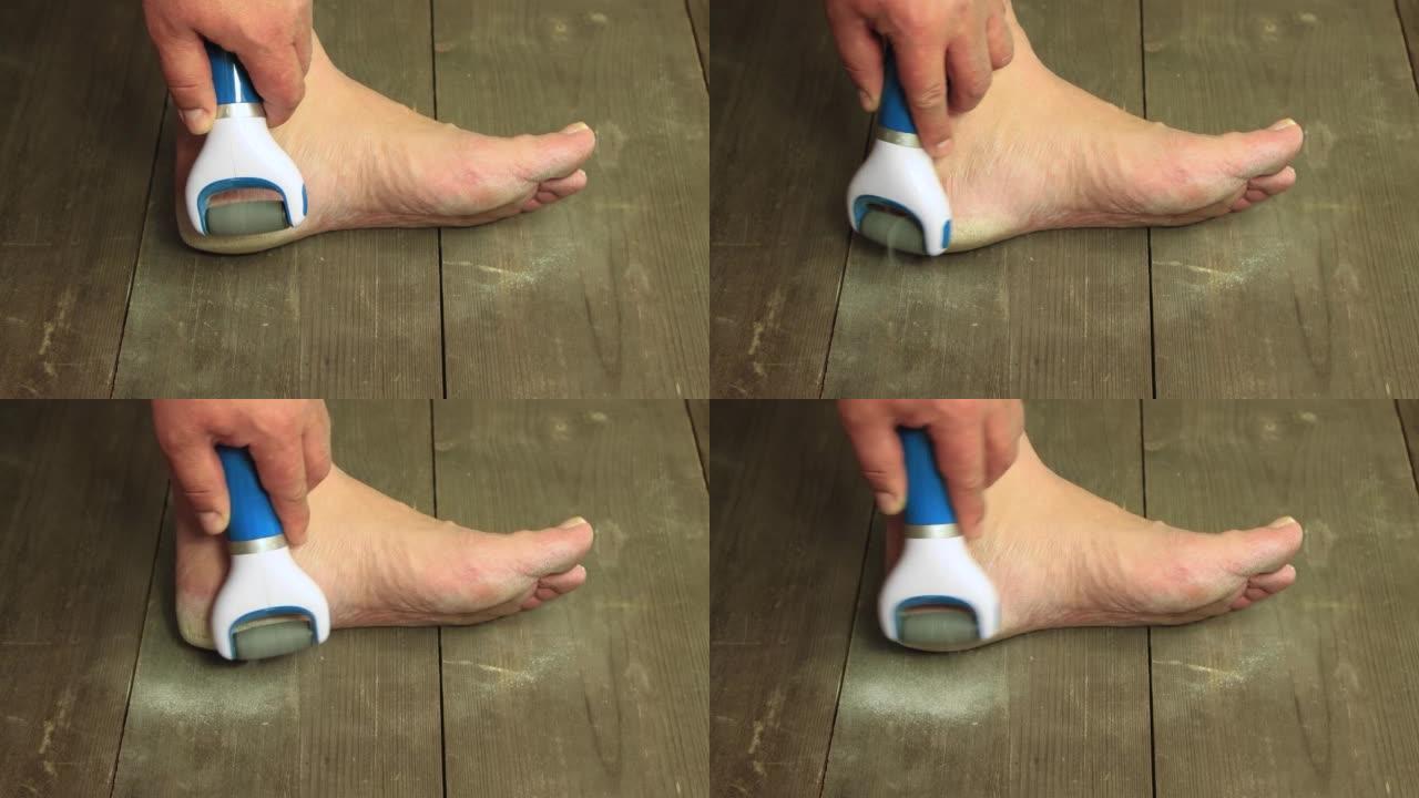 电动磨砂器清洁脚后跟。