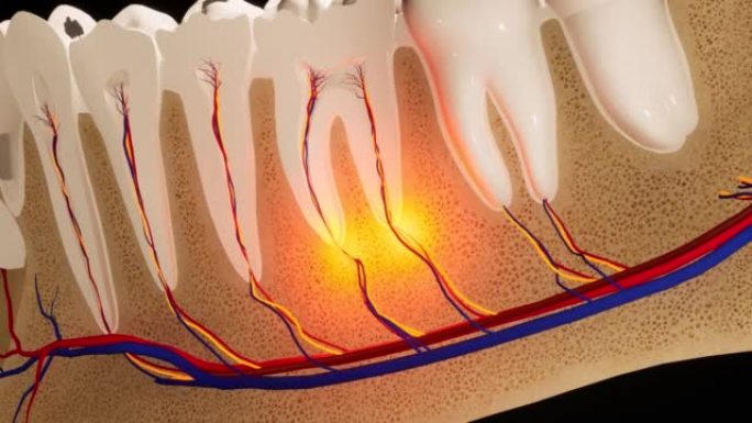 牙痛。牙齿的解剖详细部分。神经发炎。3D动画