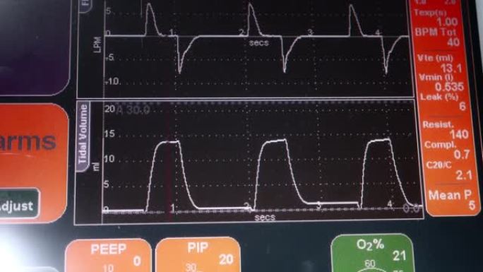 呼吸机急救心电图检查身体