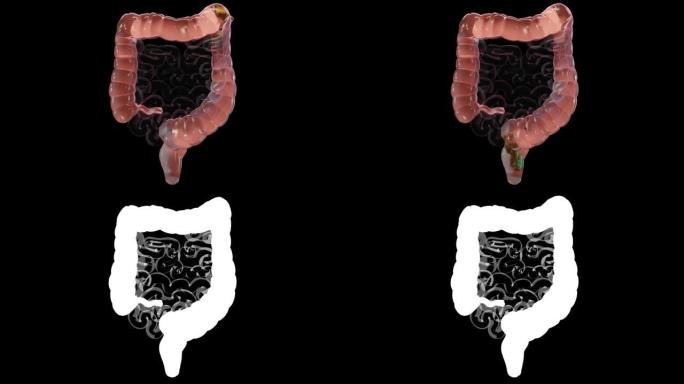 人体消化系统解剖，肠道概念，α 通道，泻药，便秘，3d渲染