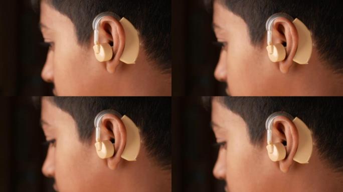 助听器概念，有听力问题的十几岁男孩。