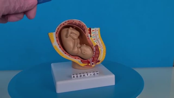 妇科医生持手术刀和流产儿童胎儿解剖