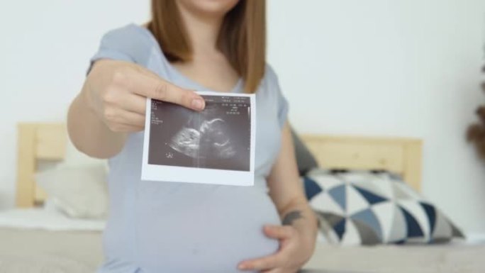 监测怀孕的现代技术。通过超声波确定孩子的性别。未出生婴儿的第一张胎儿照片