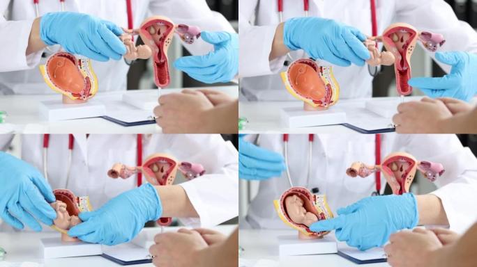 妇科医生展示女性的子宫结构和胎儿的布局