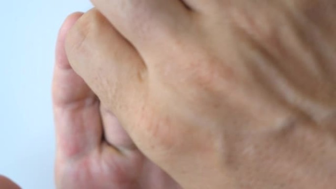 男性将医用绷带胶带贴在受伤的酸痛手指上。男子在手指伤口上涂抹创可贴。事故后急救，自我治愈帮助概念。特