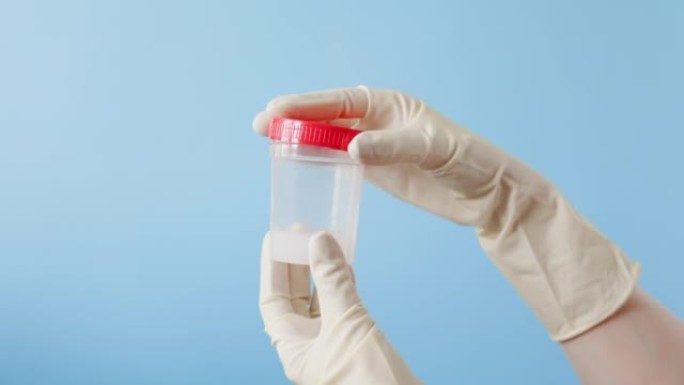 医生戴着白色医用手套的手握着一罐用于分析的精子，并关闭了试管。蓝色背景。精子捐献和阳痿的概念