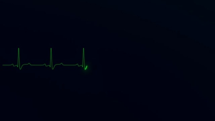 Heart ECG cardiogram