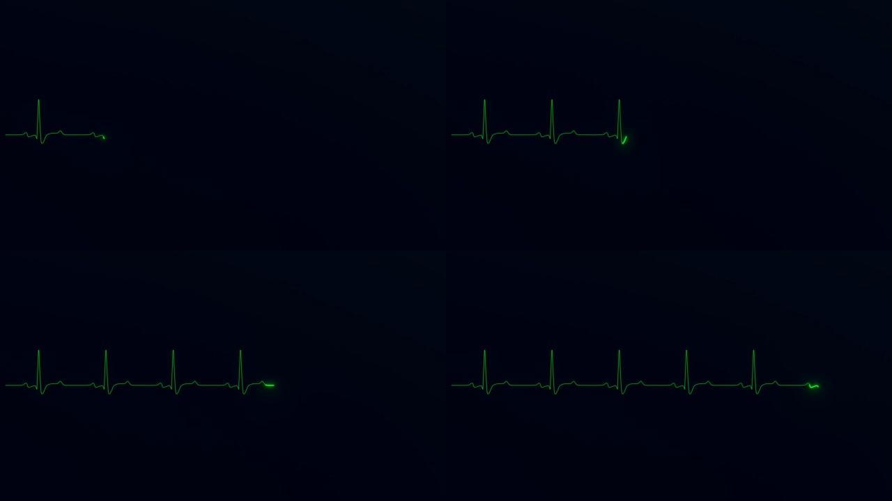 Heart ECG cardiogram