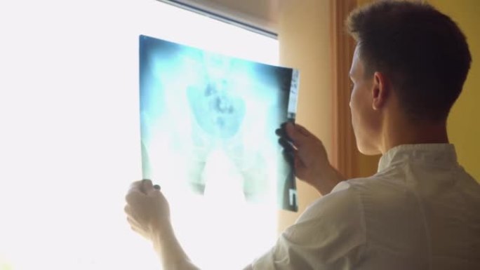 年轻的医生在诊所检查脊柱x射线。脊柱损伤诊断。医学、保健和人的概念