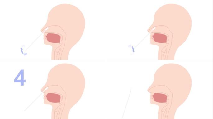 这是一个动画视频，展示了用鼻拭子溶液收集的标本。可循环