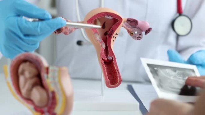 妇科医生向患者展示子宫解剖及卵巢超声检查