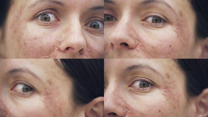 皮肤干燥的女性面部的4k慢动作视频。