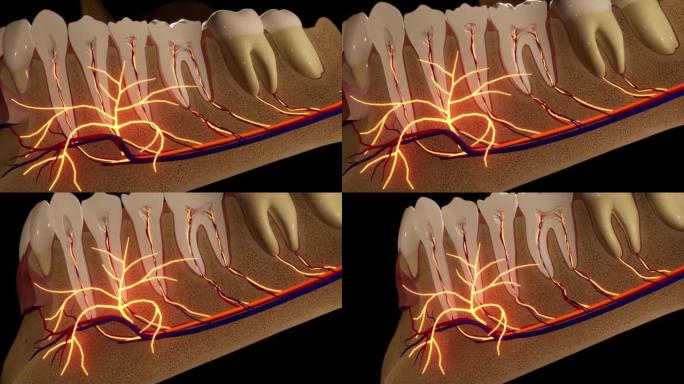 牙痛。牙齿的解剖详细部分。神经发炎。3D动画