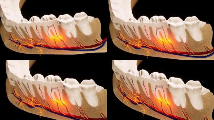 牙齿-细节模型-黑色背景上的3D模型动画。神经，切牙齿，动脉。