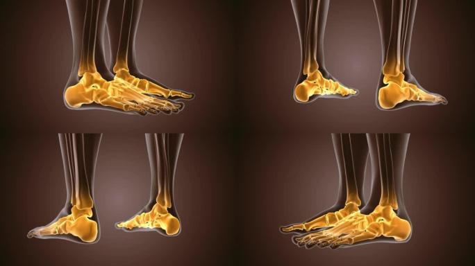 人体脚踝疼痛的3d渲染