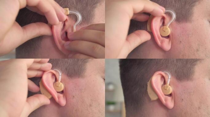 听力障碍的人将助听器插入她的耳朵特写