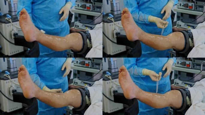 外科医生在手术前对腿部进行消毒准备。医生在膝关节做关节镜手术，在手术室内使用现代关节镜工具
